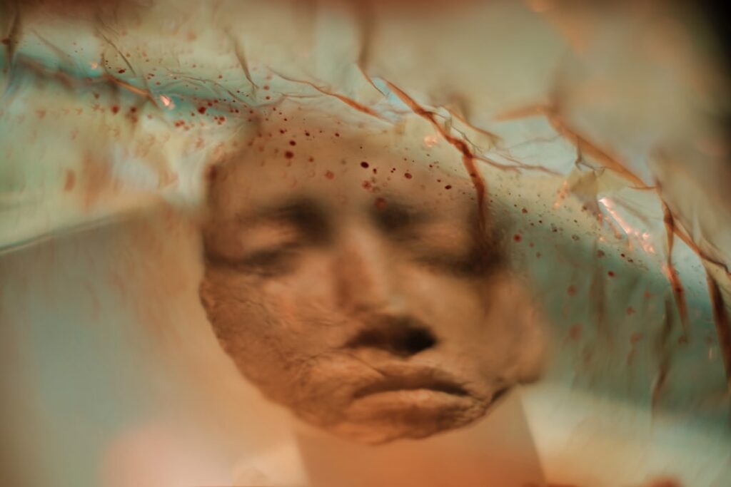 can trauma cause memory loss