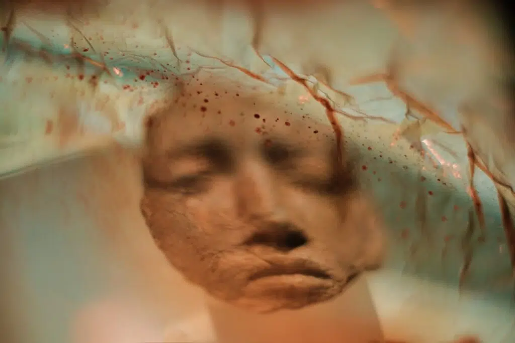 can trauma cause memory loss